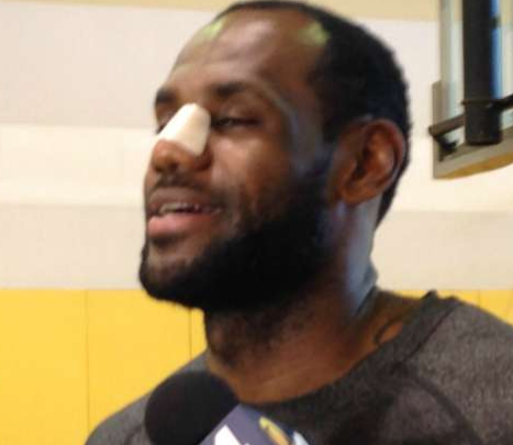 LeBron James at news conference with nasal cast on his nose follow nasal fracture repair.png