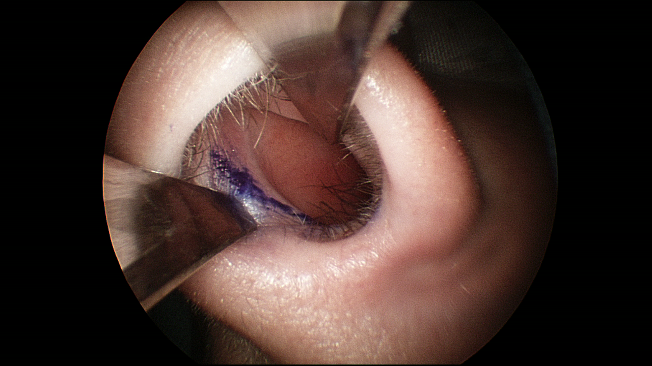 Sinus tachycardia cleveland medical institution what's sinusitis home treatments