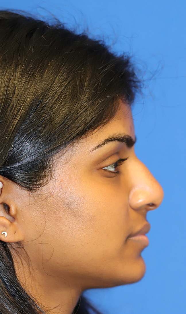 R profile before