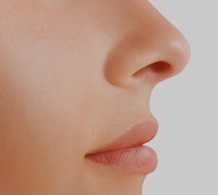 Rhinoplasty Treatments