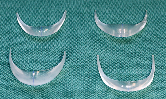 chin implant shape variety frontal.jpg