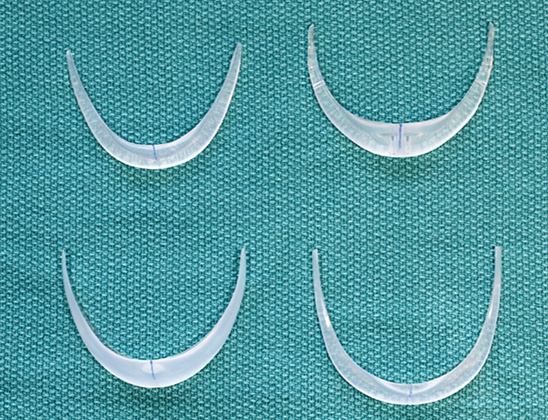 chin implant shape variety superior.jpg