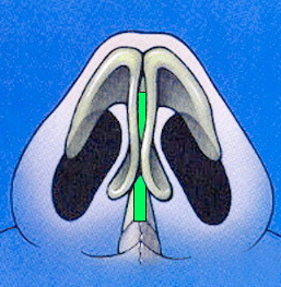 Columellar strut schematic drawing base view