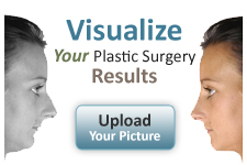 Click here to use our Face touch up plastic sugery visualization tool