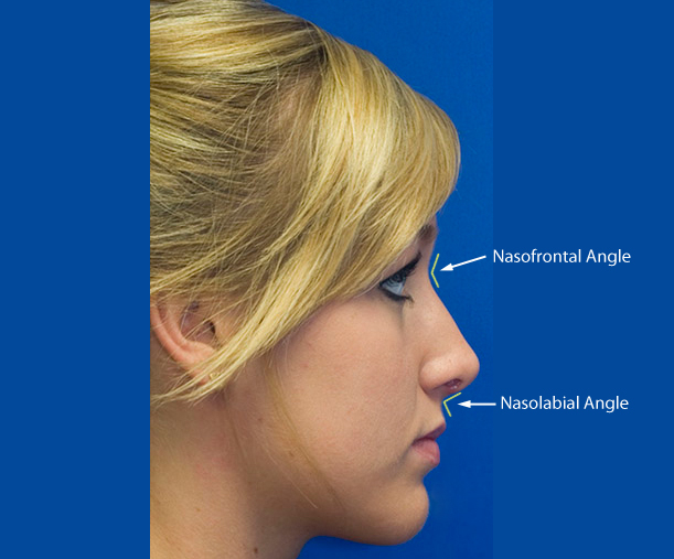 Rhinoplasty Anatomy | Rhinoplasty in Seattle