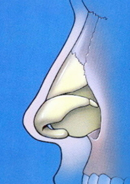 Normal nasal anatomy profile showing bone and cartilage components