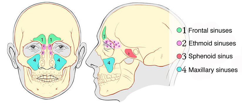 Schematic of paranasal sinuses on frontal and profile view with maxillary, frontal, ethmoid and sphenoid sinuses labelled. Image courtesy of Michał Komorniczak, MD - medical illustrations - Poland